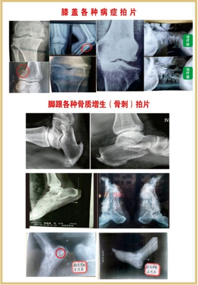 杨宗仙：中医传承创新领路人，为民治病写下传奇故事