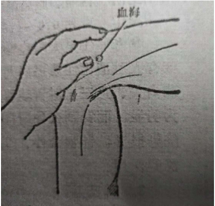 聚焦两会·中医药传承创新：韩礼医师以经方智慧守护人民健康